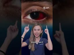 Is your eye bleeding? Don’t panic just yet. 😳