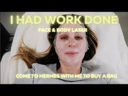I HAD WORK DONE ON MY FACE & BODY. SHOWING YOU EVERYTHING! COME TO HERMES TO BUY A BAG