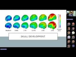 Children and infants with skull fractures Pediatric Grand Rounds 4 25 25