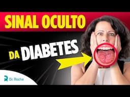 🛑 BOCA SECA é um SINAL PERIGOSO de DIABETES que quase NINGUÉM LEVA A SÉRIO!