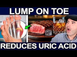 URIC ACID DETOX IN 1 WEEK! - How To Cleanse And Eliminate Hyperuricemia