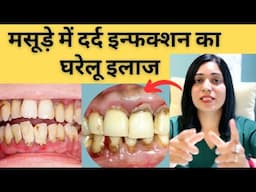 मसूड़े में सूजन, इन्फेक्शन और दर्द का बेस्ट घरेलु तरीका | Home Remedy For Gum Infection |