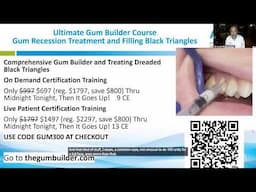 Dentists Game Changing Gum Filler Eliminates Black Triangles in One Visit