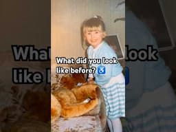 ♿️ What did you look like before?  Do you find it difficult to see yourself before?