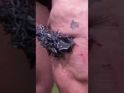 A Spike Went ALL THE WAY In My Leg 😵 #shorts #funny #comedy