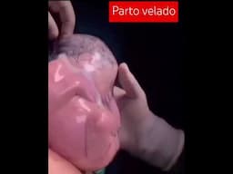 Parto Velado. #Nacimiento #Placenta #Bebé