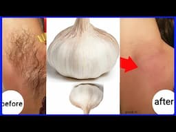 Only 1 garlic get rid of facial hair permanently fast / unwanted hair removal permanent naturally
