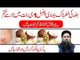 Chambal Ka elaj | Tadar Ka elaj | Dr Sharafat Ali