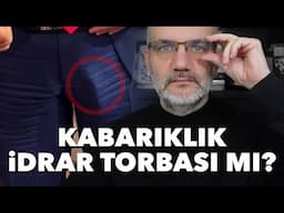 Diz altındaki kabarıklık idrar torbası mı? | Tarık Toros | Manşet | 12 Haziran 2025