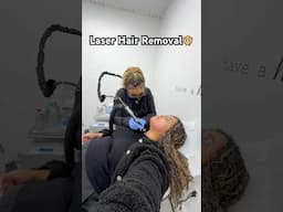 Laser hair removal 😵‍💫🙈 #laserhairremoval #beautyroutine #hairremoval