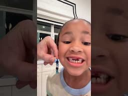 Finally Pulled Out Her Tooth! 🦷