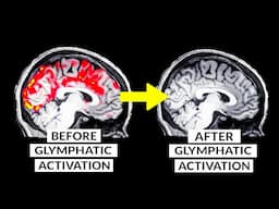 We Finally Know How To Detox The Brain Naturally