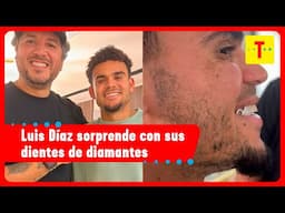 ¿Luis Díaz se desfiguró la cara? Su nuevo look causa impacto | Tropicana