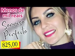 UM SONHO REALIZADO - MEU NOVO SORRISO ❤️ Por 825,00