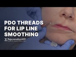 Smooth Fine Lines Above the Lip without Filler