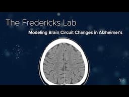 Alzheimer's, Neuroimaging, Amyloid & Tau - The Fredericks Lab at Yale School of Medicine