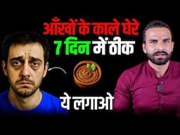 Dark Circle केवल का कारण और पक्का इलाज समझ लो / Dark Circle under eyes Home Remedy
