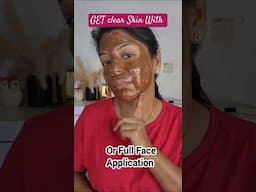 Acne Pimple Home Remedy to Get Clear Skin #tanremoval #acnetreatment #pimplecare #skincare