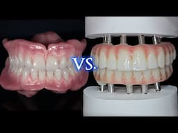 DENTURES vs IMPLANTS vs SNAP-INs vs All-On-4! Pros & Cons Of Permanent & Immediate.
