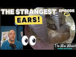THE STRANGEST EARS! Episode 457