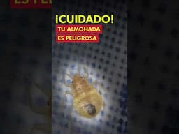 ¡Alerta! Tu almohada podría estar llena de ácaros sin que lo sepas  @ParamédicoCarlosGuerrero