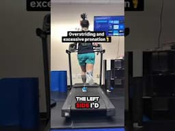 Overstriding and Excessive Pronation 🦶