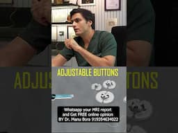ACL Screw vs Internal Brace Quadpro – कौन सी सर्जरी है सही?
