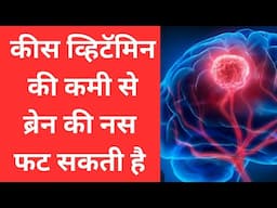 कीस व्हिटॅमिन की कमी से ब्रेन की नस फट सक्ती है||brain stroke due to deficiency of these vitamin