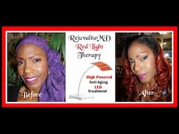 Rejuvalite MD Anti-Aging Light Therapy System Review + Demo