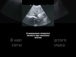 #узи #воротнаявена