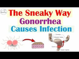 The Sneaky Way Gonorrhea Causes Infection | What Gonorrhea Is and How It Causes Infection