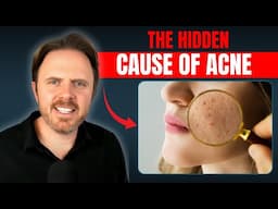 Is Low Vitamin A Causing Your Acne? Dermatologists Won’t Tell You This - Dr. J Live Q & A