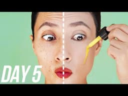 I Used Retinol Only On Half Of My Face For 1 Week