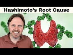 Shocking Link Between Hashimoto's and Low Iron