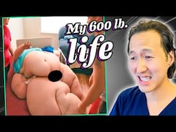 Lymphedema, Masses & More: Doctor Reacts to My 600 Lb Life Compilation!