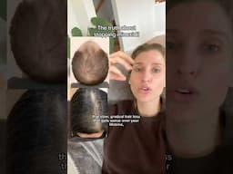 This #hairloss myth needs some clarification!