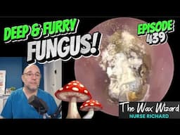 DEEP AND FURRY FUNGUS! Episode 439