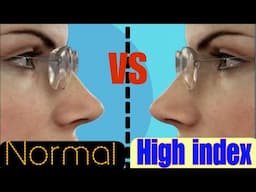 Can You Really Improve Your VISION with HIGH INDEX GLASSES?