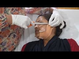 Best Double Jaw Surgery - Pack Removal Recovery - Day 7