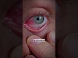 What if you never blinked? 👀 | #healthandwellness #shorts