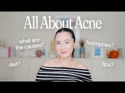 All About Acne (Causes, Hormones, Gut, Tips) | Camille Co