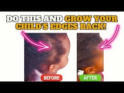 How to Grow Your Little One’s Edges Back– The Truth About Edge Care!