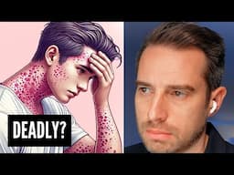 Can you get measles after vaccination?