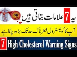 Top 7 High Blood Cholesterol Warning Signs In Urdu