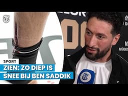Ben Saddik reageert op heftige snee: 'Verdien tweede kans'