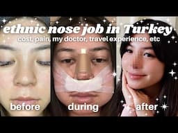 I GOT A NOSE JOB IN TURKEY // asian ethnic rhinoplasty with Dr. Alpaslan Yildirim (@estetik_burun) ✿