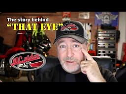 The Truth About My Eye That Everyone Keeps Asking About!