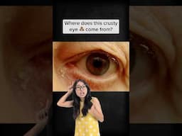 Where does eye boogers come from?