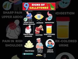10 Early Signs of Gallstones – Don’t Miss These Symptoms!