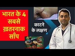 सांप काटे तो ये 4 लक्षण देखकर तुरंत अस्पताल जाएँ! | भारत के 4 सबसे खतरनाक सांप और ज़हर का असर